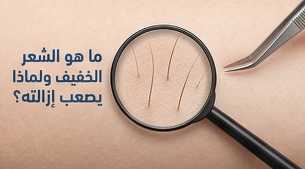 ما هو الشعر الخفيف ولماذا يصعب إزالته؟